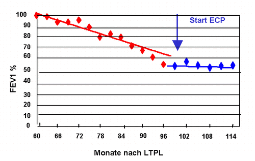 Verlaufsdiagramm